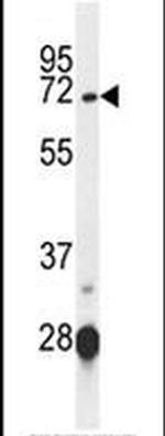 KLHL23 Antibody in Western Blot (WB)