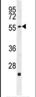 RGAG4 Antibody in Western Blot (WB)