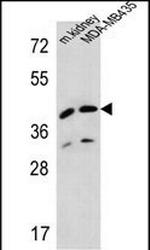 L2HGDH Polyclonal Antibody