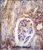 DYNLRB2 Polyclonal Antibody