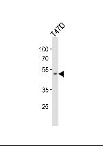 HOXA10 Antibody in Western Blot (WB)