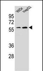 HOXA10 Antibody in Western Blot (WB)