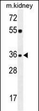 KLF14 Polyclonal Antibody