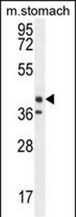 TECTB Antibody in Western Blot (WB)
