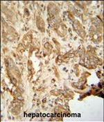 NAT14 Polyclonal Antibody