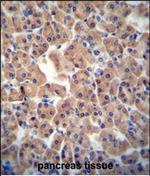 CTU1 Polyclonal Antibody