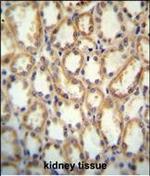 KCNT2 Polyclonal Antibody