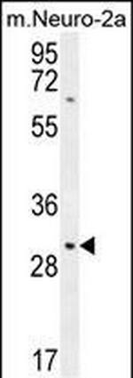 TMEM65 Polyclonal Antibody