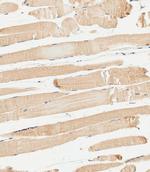 METTL4 Polyclonal Antibody