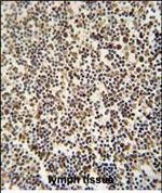 DENND1B Polyclonal Antibody