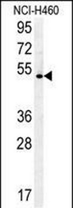 DENND1B Antibody in Western Blot (WB)