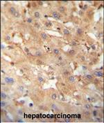 NEU4 Polyclonal Antibody
