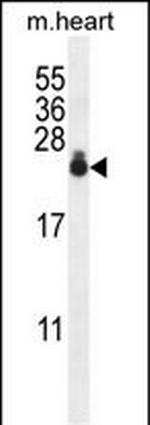 AP1S3 Antibody in Western Blot (WB)