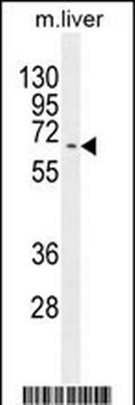 KY Polyclonal Antibody