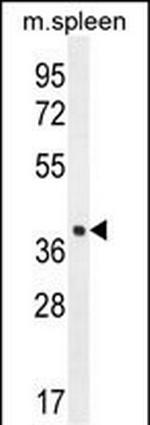 LHFPL5 Polyclonal Antibody