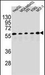 PAX1 Polyclonal Antibody