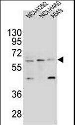 LILRA2 Polyclonal Antibody