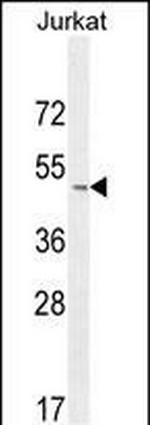 CD162 Polyclonal Antibody