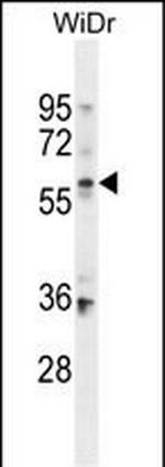 BCMO1 Polyclonal Antibody