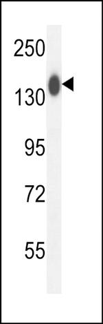 COL19A1 Antibody in Western Blot (WB)