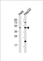 E2F2 Polyclonal Antibody