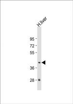 GNA15 Polyclonal Antibody