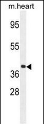 GNA15 Antibody in Western Blot (WB)