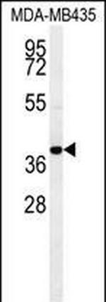 CCR8 Polyclonal Antibody