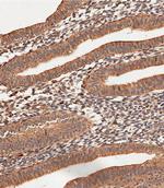 Collagen V Polyclonal Antibody