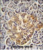 PRSS3 Polyclonal Antibody