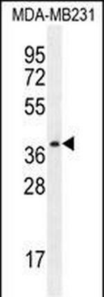PRSS3 Antibody in Western Blot (WB)