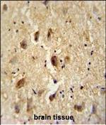 Vitrin Polyclonal Antibody