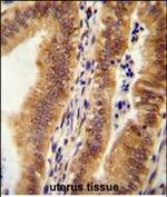 KIAA1609 Antibody in Immunohistochemistry (Paraffin) (IHC (P))