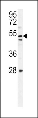 KIAA1609 Antibody in Western Blot (WB)