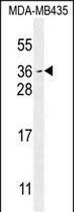 MYCT1 Polyclonal Antibody