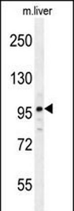 NARG2 Polyclonal Antibody