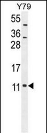NDUFA11 Antibody in Western Blot (WB)