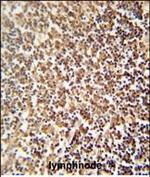 ZNF98 Polyclonal Antibody