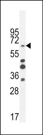 ZNF98 Antibody in Western Blot (WB)