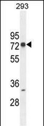 ZNF780A Polyclonal Antibody