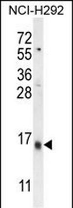 LY6G6C Antibody in Western Blot (WB)