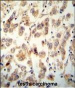TTC16 Polyclonal Antibody