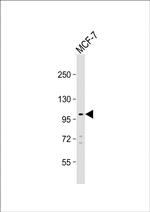 TTC16 Antibody in Western Blot (WB)