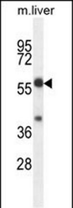 TBCCD1 Polyclonal Antibody