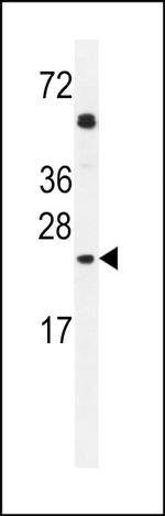 GOLGA2L1 Antibody in Western Blot (WB)