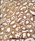 DEGS2 Polyclonal Antibody