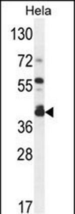 DEGS2 Antibody in Western Blot (WB)
