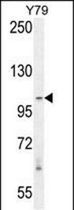 RASAL3 Antibody in Western Blot (WB)