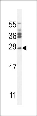 JOSD2 Polyclonal Antibody