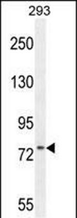 ZNF611 Polyclonal Antibody